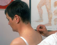 Patient recieving acupuncture at Brook Green Clinic Hammersmith